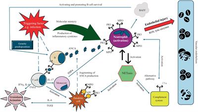 Granulomatosis with polyangiitis: clinical characteristics and updates in diagnosis